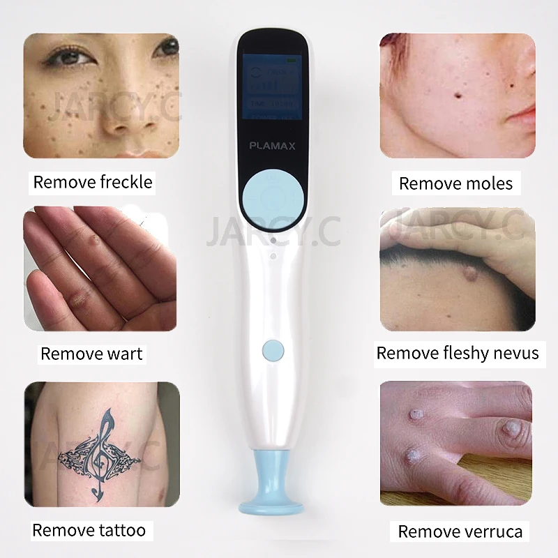 Озонотерапия 2 в 1 плазменная ручка для фибробластов Plamax подтяжка век