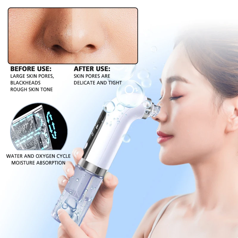 

Blackhead Remover Vacuum Skin Cleaner Acne Suction Pimple Black Head Remove Black Points Face Skin Cleaning Suction Blackheads
