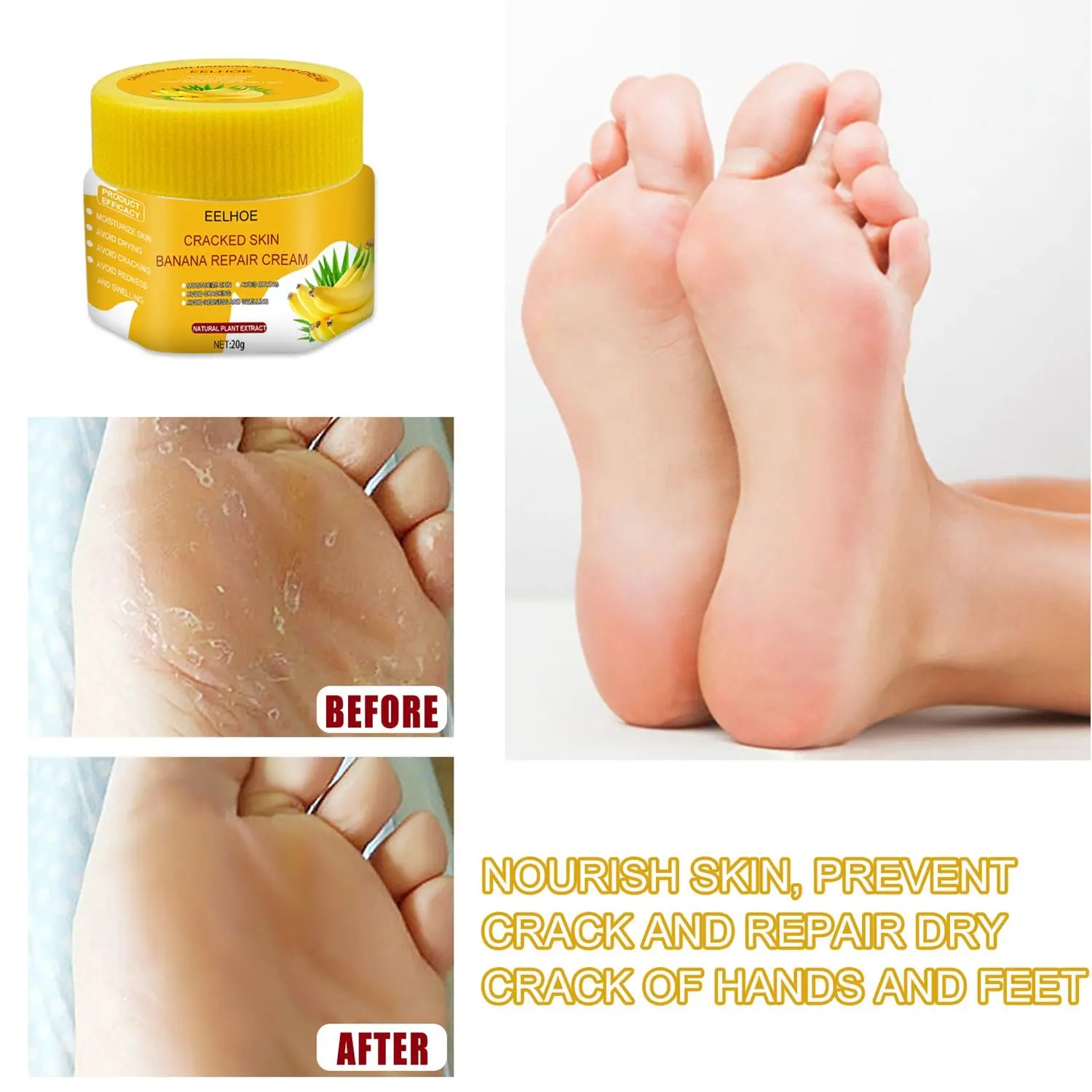 

Anti Chapped Odor Treatment Anti Fungal Skin Care Product Banana Oil Repair Dead Skin Remover Anti-Drying Crack Cream