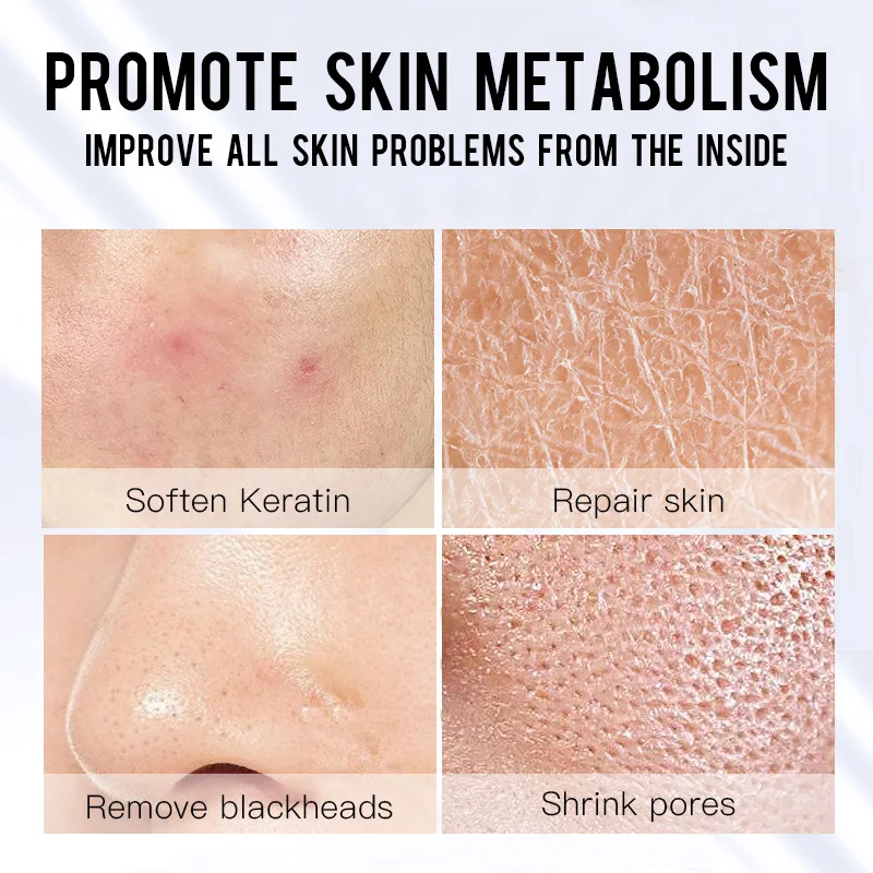 Daralis 35 мл отшелушивающая жидкая Сыворотка для лица глубокое очищение эссенция