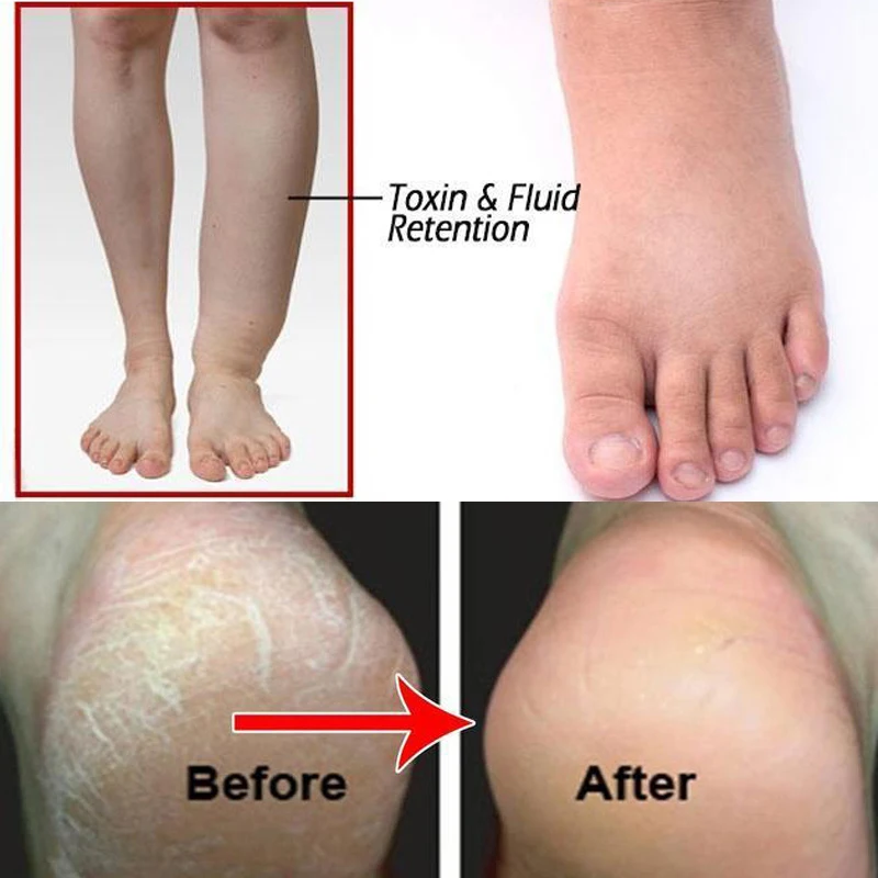 10 шт./лот спа-таблетки против отеков для ног имбирь замачивание шипучие таблетки