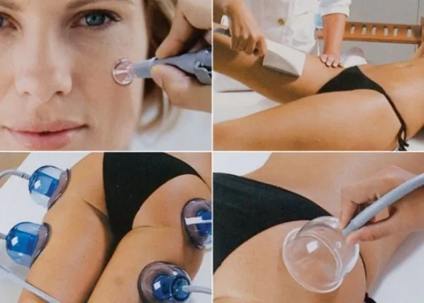 Лучшая Красота starvac целлюлитная машина для похудения тела|Устройство ухода за