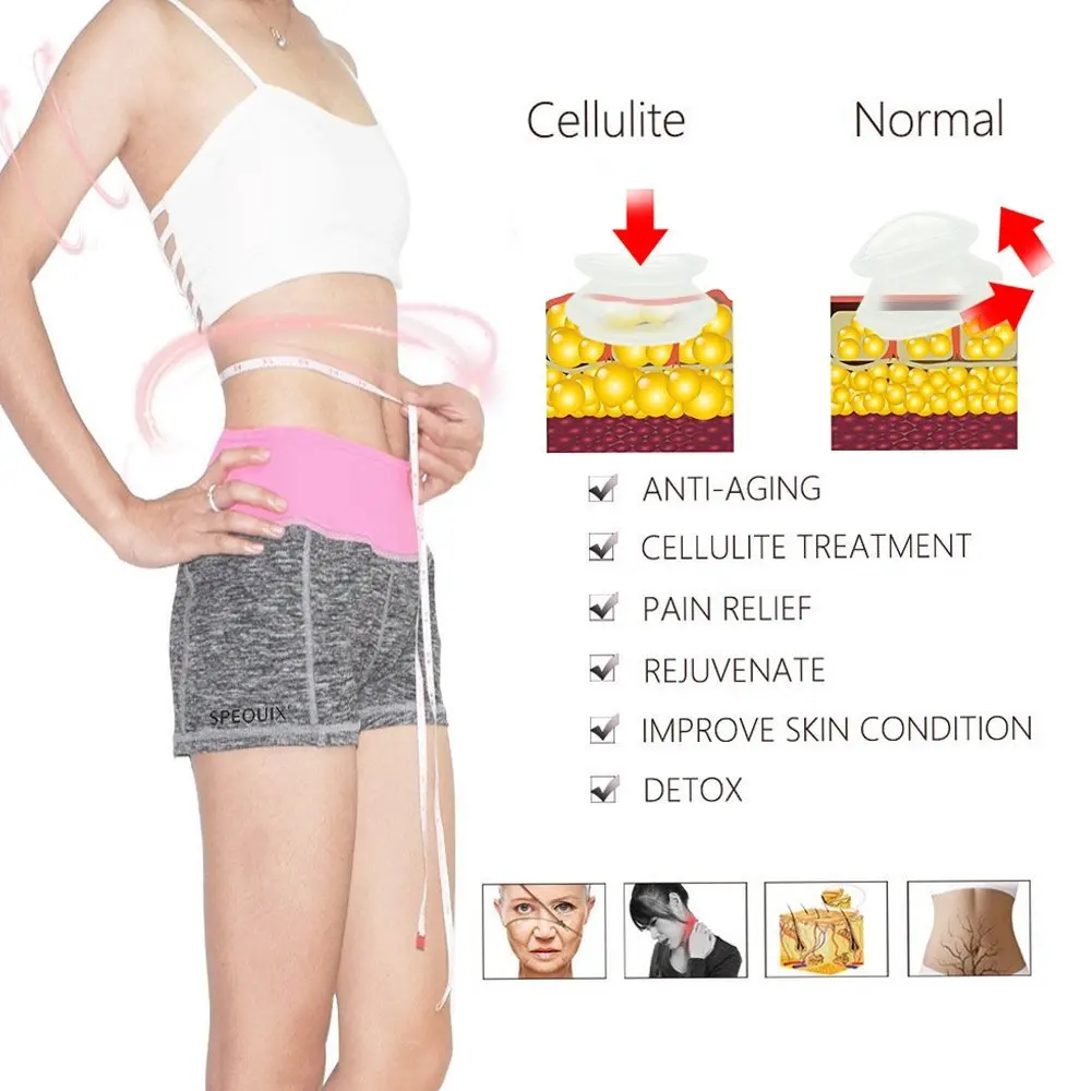 SPEQUIX 3 ПК Пластиковый Стакан Чашка для терапии вентуз антицеллюлитный уход за