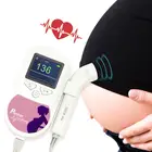 Монитор сердечного ритма плода CONTEC, допплер с подсветкой, ЖК-дисплей, розовыйсиний, 2 МГц, 3 МГц, зонд, Детское сердце