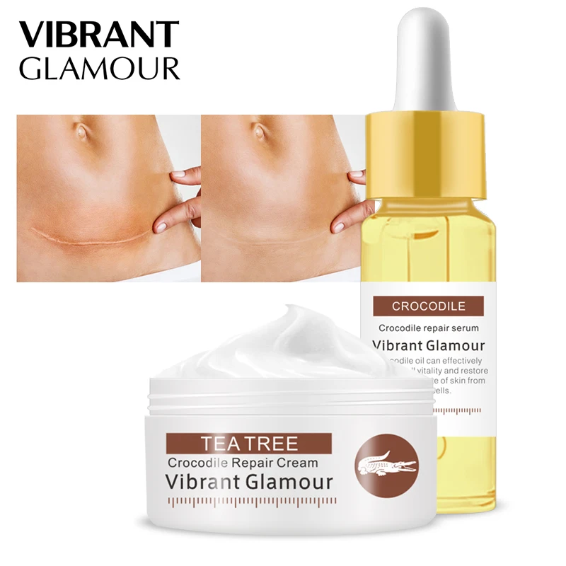 Крокодиловый Восстанавливающий шрам сыворотка крем для лица Отбеливание акне