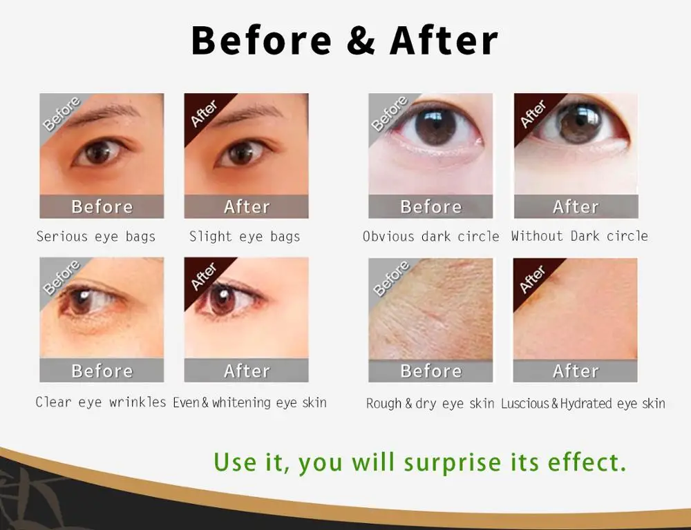 С бамбуковым древесным углем для ремонта увлажняющая маска глаз уход за кожей