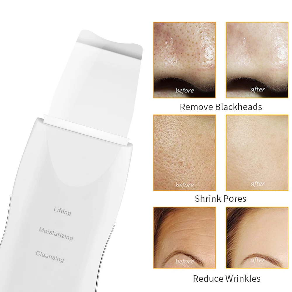

Ultrasonic Scrubber Deep Cleansing Face Scrubber Facial Cleansing Shovel Exfoliating Skin Scraper Peeling Beauty Instrument Tool