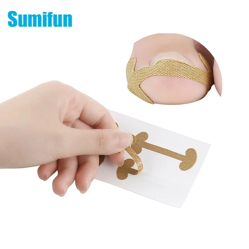 20 шт. инструмент для лечения пароникьи выпрямления машинка стрижки стикер