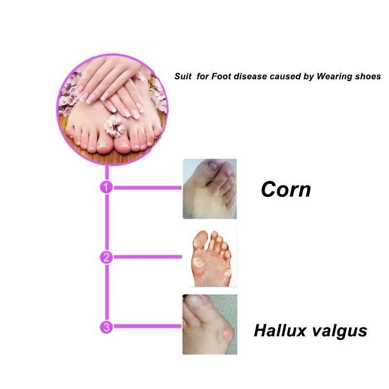 Горячая продажа ортопедическая выпрямляющая машина силиконовый гель носок для