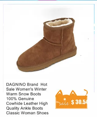 DAGNINO/женские теплые зимние сапоги из натуральной овечьей кожи; женские ботильоны с натуральным мехом и пуговицами высокого качества