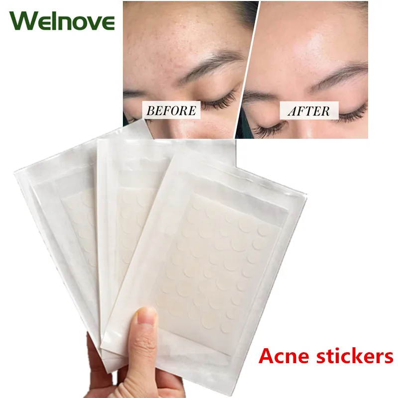 144 шт. = 4 пакета наклейки для удаления акне|Пластыри терапевтические| |