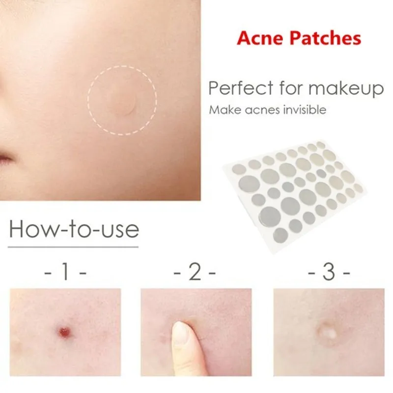 36 шт. пластырь для лечения акне|Устройство ухода за кожей лица| |