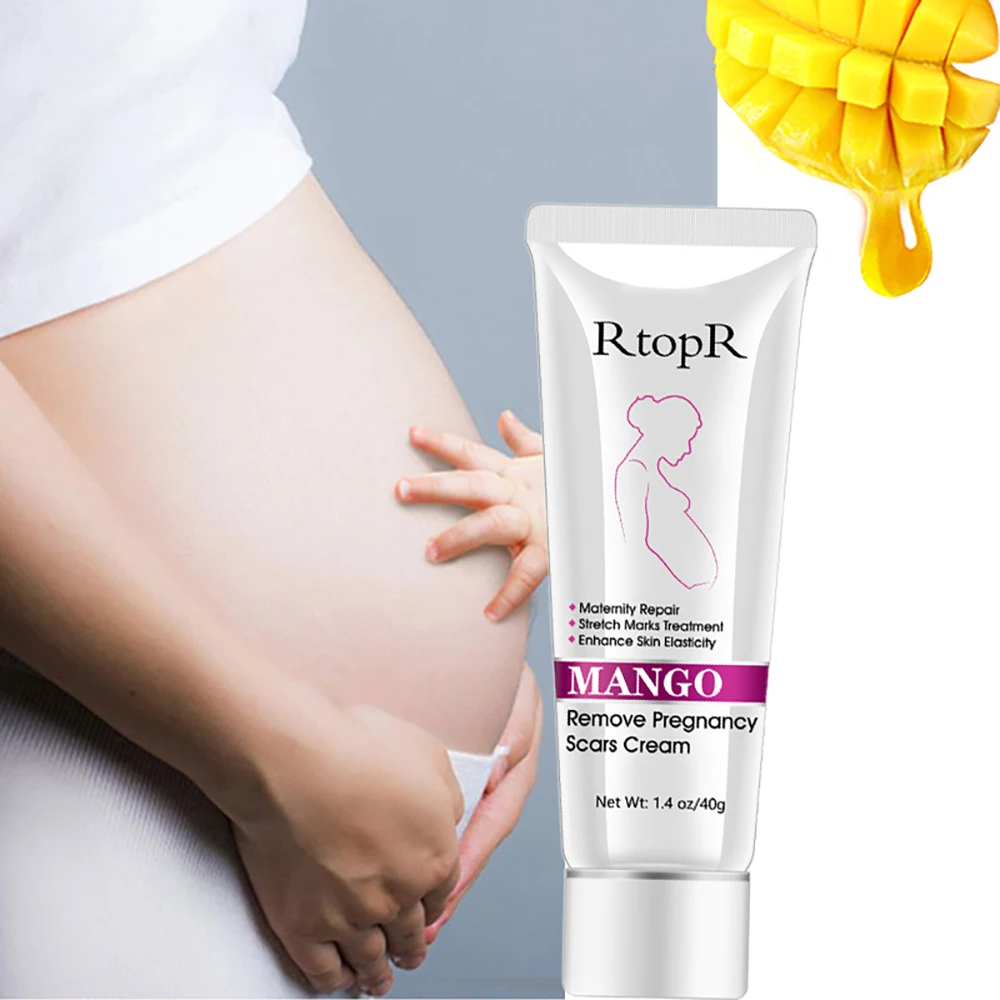 Treatment Stretch Mark Cream Fade Obesity Lines Promote Cell Regeneration Enhance Skin Elasticity Pregnant Women Postpartum Care | Красота и