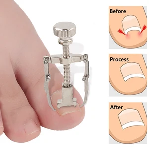 Ingrown Toe Pedicure Foot Nail Care Correction Tools File for Feet Orthotic Acronyx Ingrowing Nail O