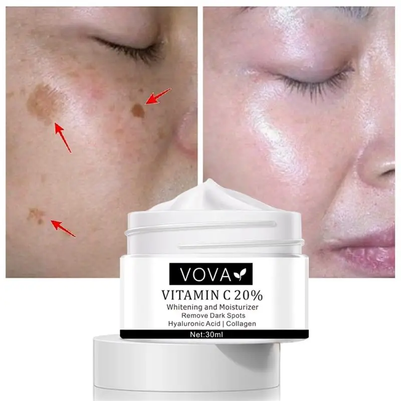 

Vitamin C 20% Whitening Freckle Face Cream Remove Dark Spots Facial Gel Repair Fade Freckls Melanin Remover Brighten Skin Care