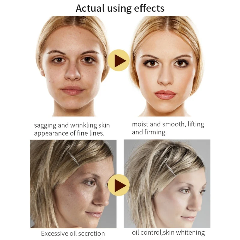 Дереза обыкновенная эфирные масла увлажняющее масло контроль укрепляющее уход