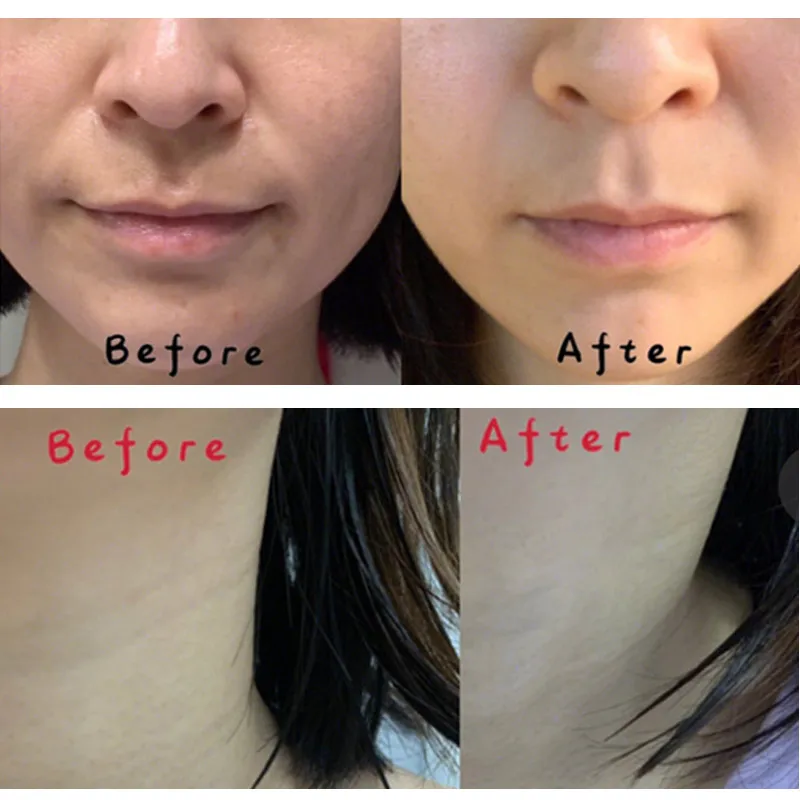 Пептидная Сыворотка для ухода за кожей лица 30 мл | Красота и здоровье