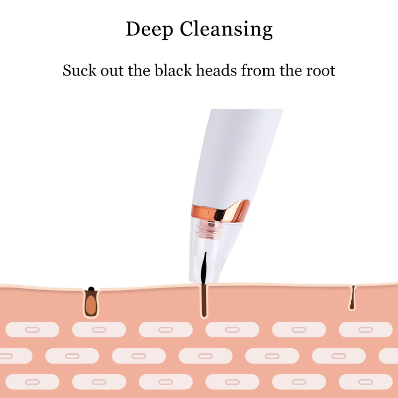 Вакуумный Очиститель пор для удаления черных точек ухода за кожей лица | Красота
