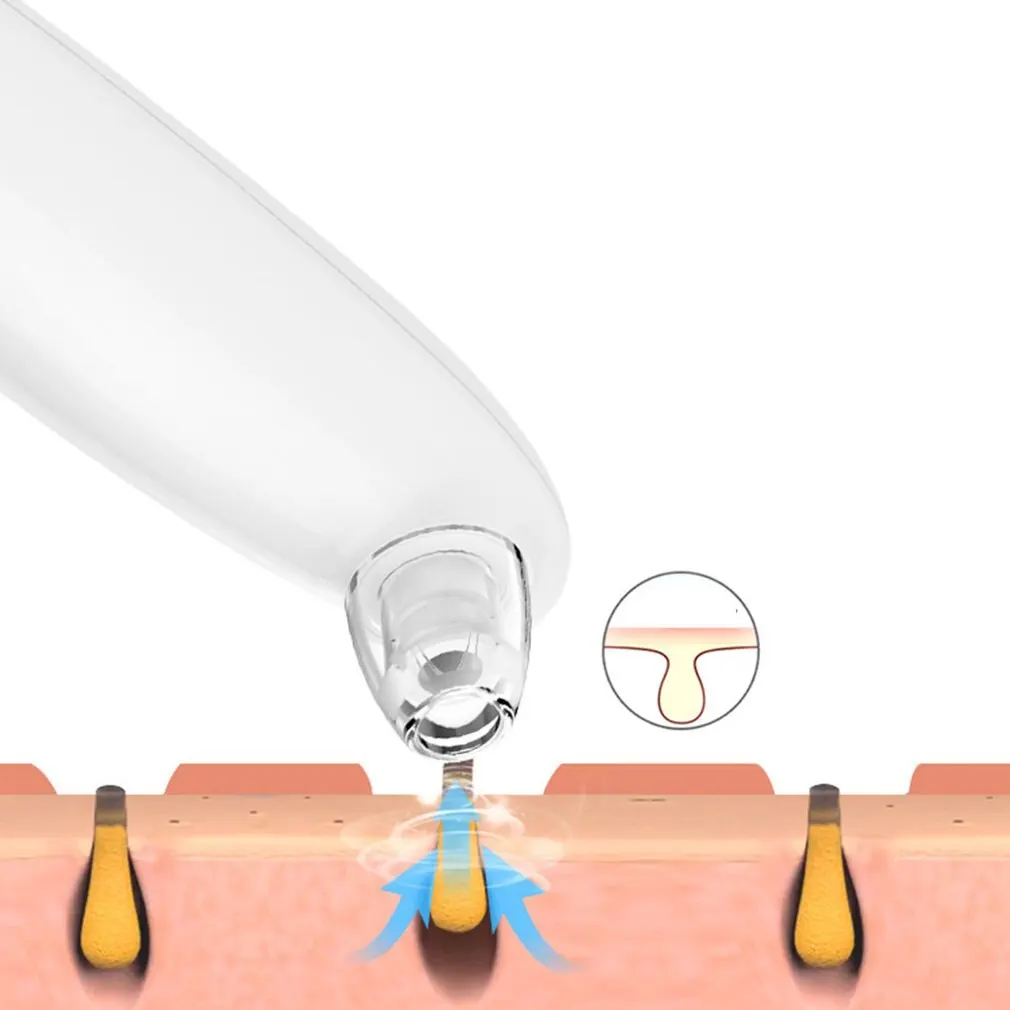 Electric Blackhead Remover Needles Acne Black Spot Extractor Vacuum Suction Deep Cleansing Machine Exfoliating Pore Cleaner | Красота и