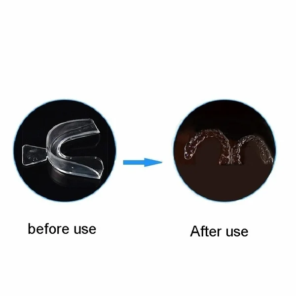 2 пары гель Отбеливание зубов брекеты рот лотки гвардии термо Спортивная Капа