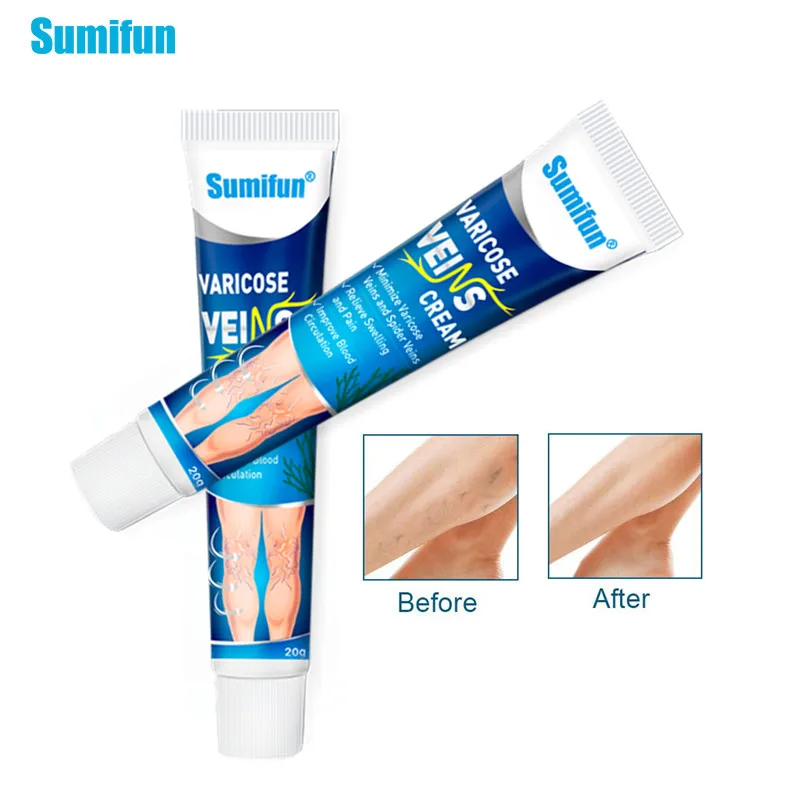Sumifun 1 шт. варикозное расширение вен лечение крем васкулита флебит паучьи ноги для