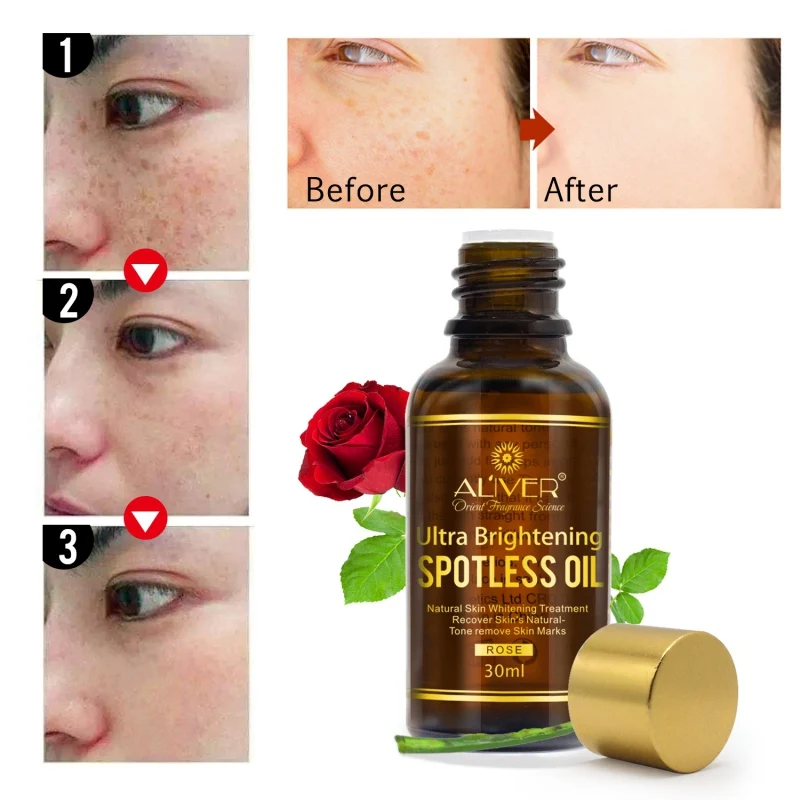 Эфирные масла розы всплеск веснушки удалить против морщин эссенция масло темные