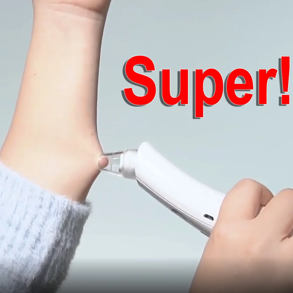 Новый инструмент для удаления угрей лица Электрический Очиститель от и черных