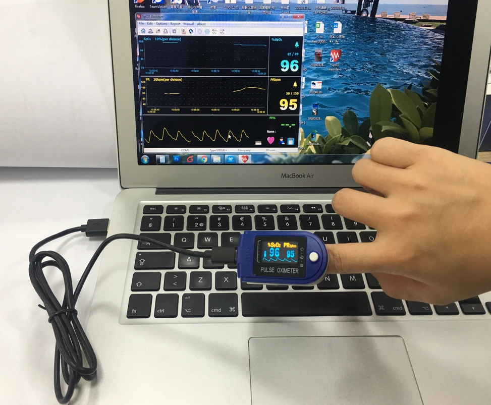 CONTEC CMS50D Plus Домашний медицинский пульсоксиметр с пальцевым наконечником и