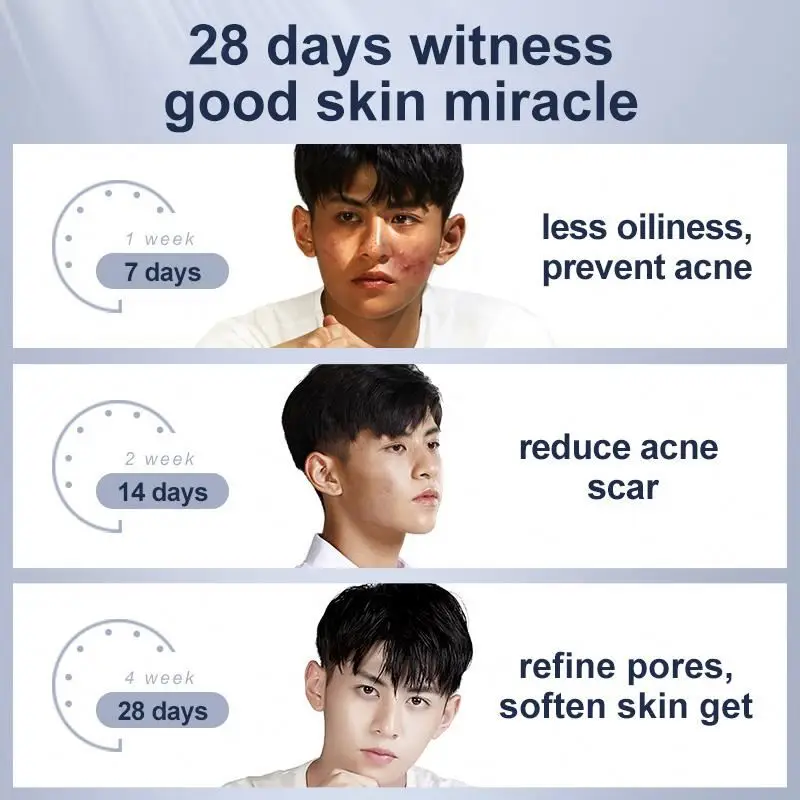 Частная торговая марка для контроля жирности лица очищающее средство от акне