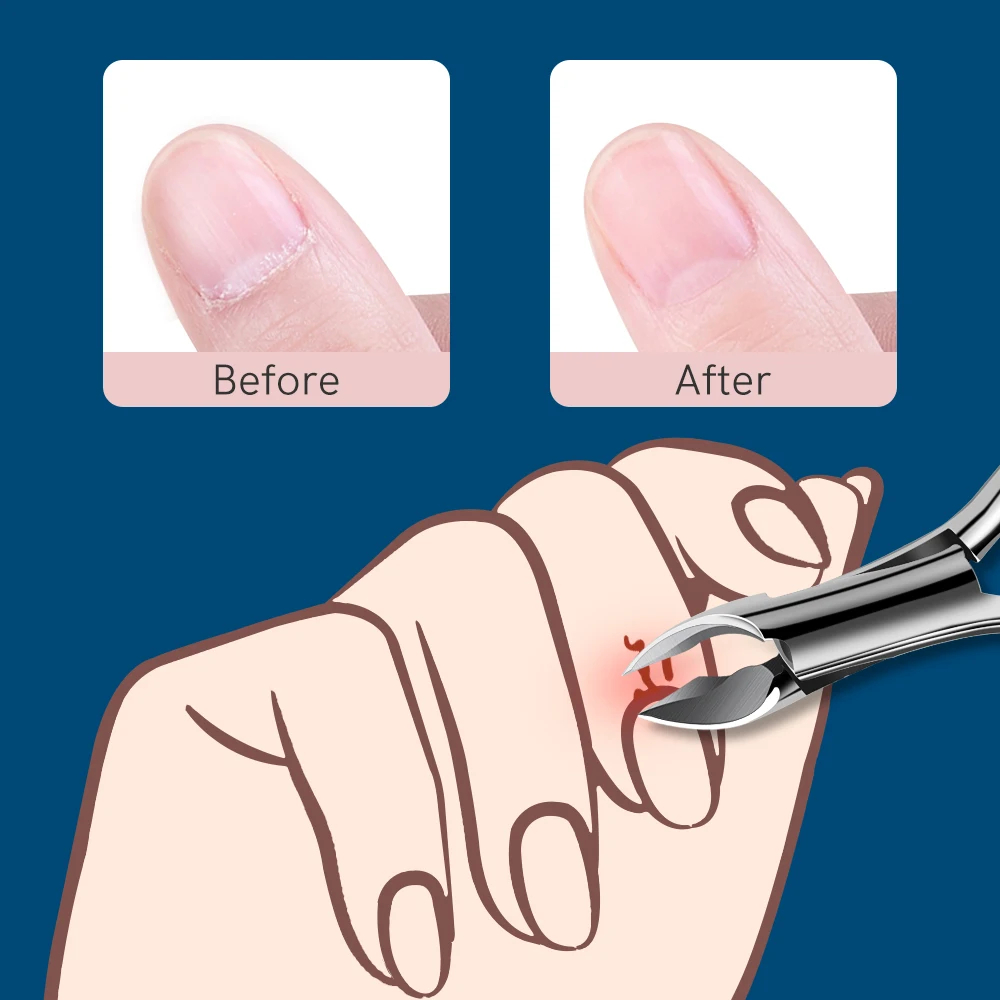 Ножницы для кутикулы Miss ли профессиональный триммер нержавеющая сталь