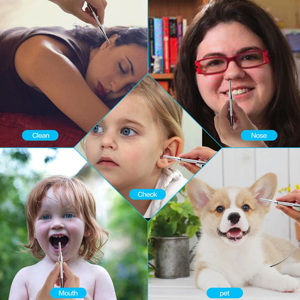 

Digital Otoscope with 6 LEDs Lights 1080P High Definition Ear Scope Camera 4.3in IPS Screen Earwax Removal Tool and Specula