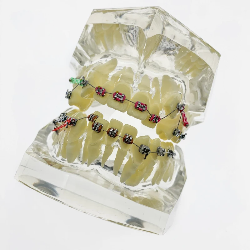 

Стоматологические модели зубов используются для обучения и больничного стоматолога