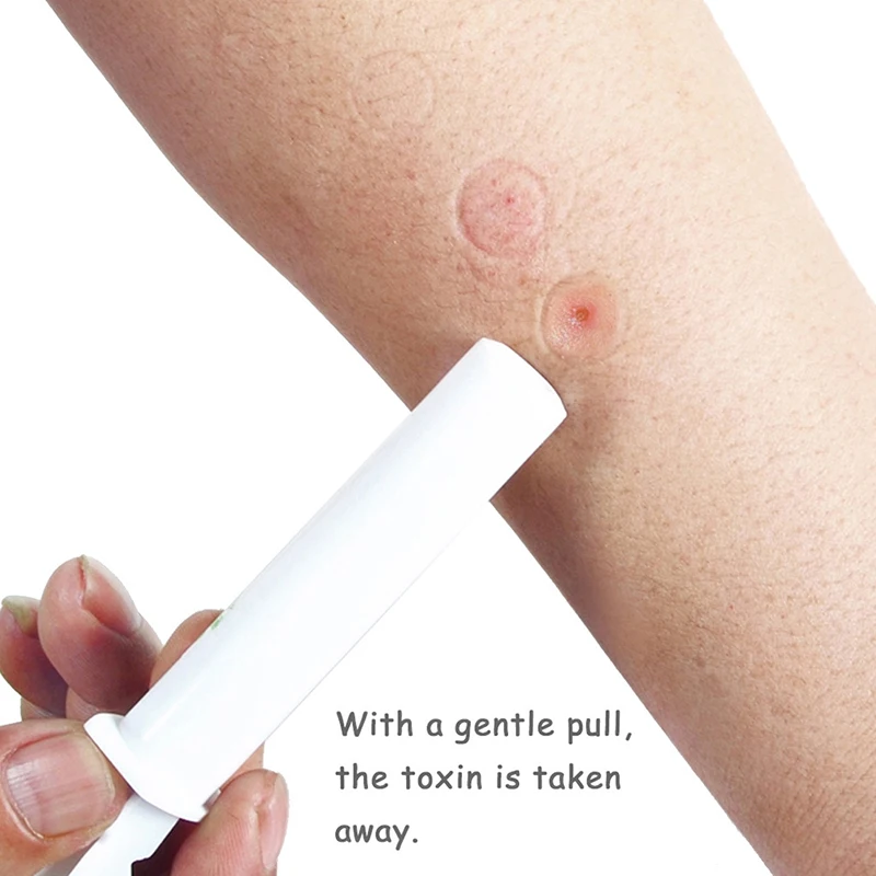 

Mosquito Electric Extractor Pump First Aid Safety Kit Snake and Bug Bites Safety Emergency Photocatalytic Effective 2020