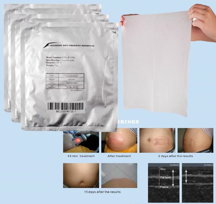 

Disposable 34x42 Antifreeze Membrane For The Zetiq Slimming Machine Anti Freeze Membrane For Cryolipolysis Treatment Use