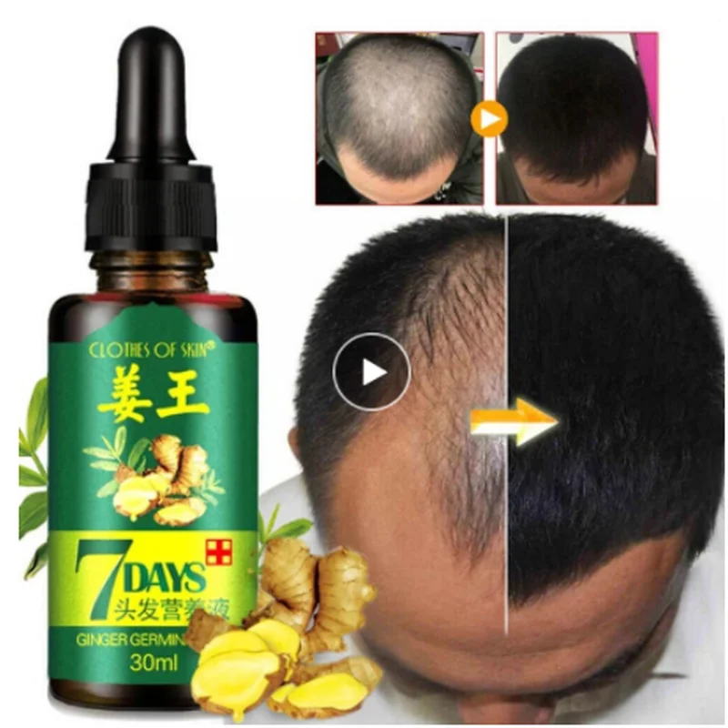 

Ginger Hair Growth Serum Germinal Hair Growth Essence Oil Hair Loss Treatement Growth Hair for Men Women Maintenance