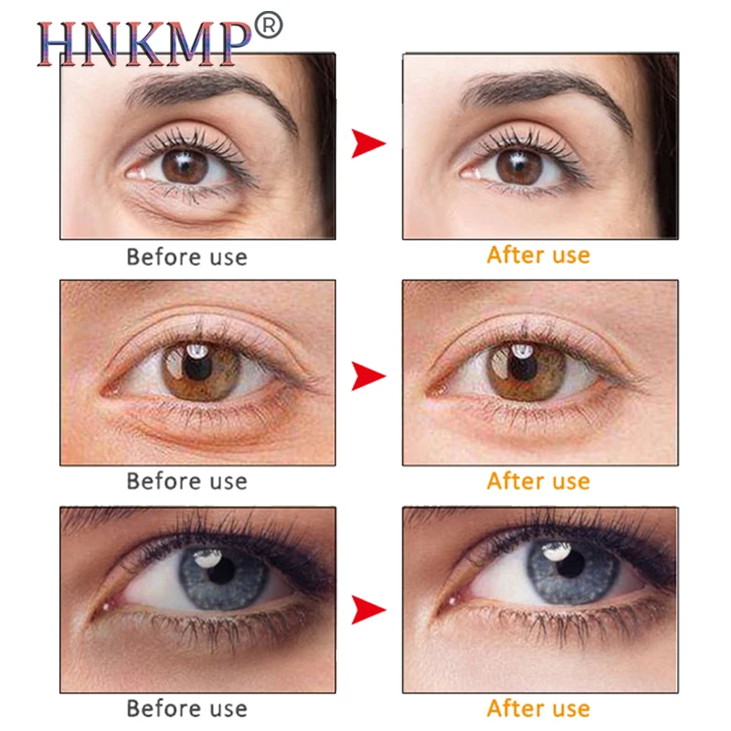 Электрический вибрирующий массажер для лица HNKMP против морщин старения