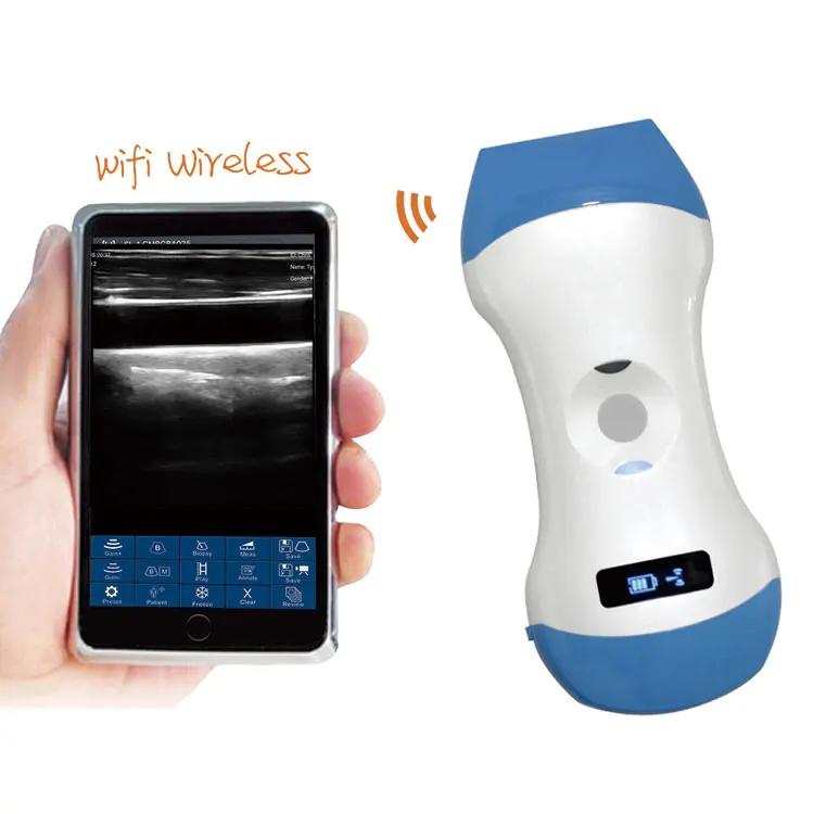 

MY-A023H medical products portable double head linear and convex wireless ultrasound probe with cheap price
