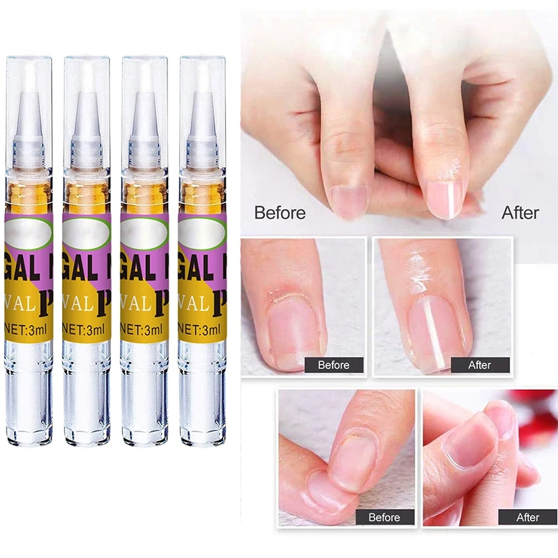 

3ml x 4pcs Fungal Liquid Nail Treatments Fingernails Toenails Nail Repair Cuticle Oil Nourishiment Tea Tree Essential Oil Pen