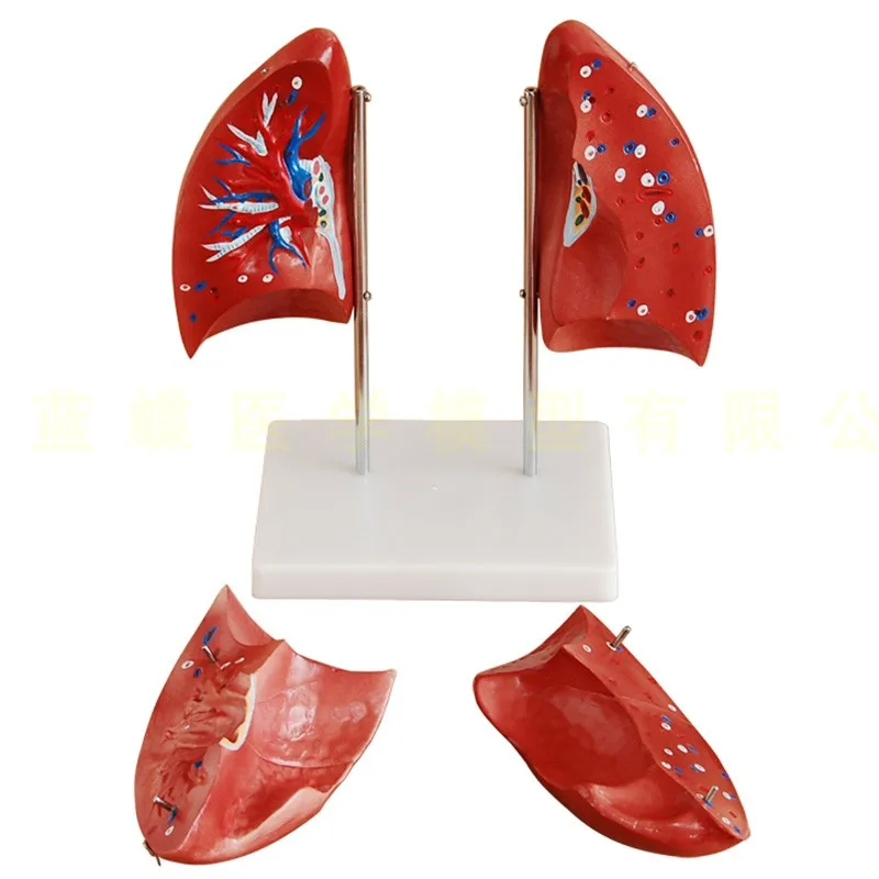 Модель анатомии легких модель человека обучающая специальная для легочного