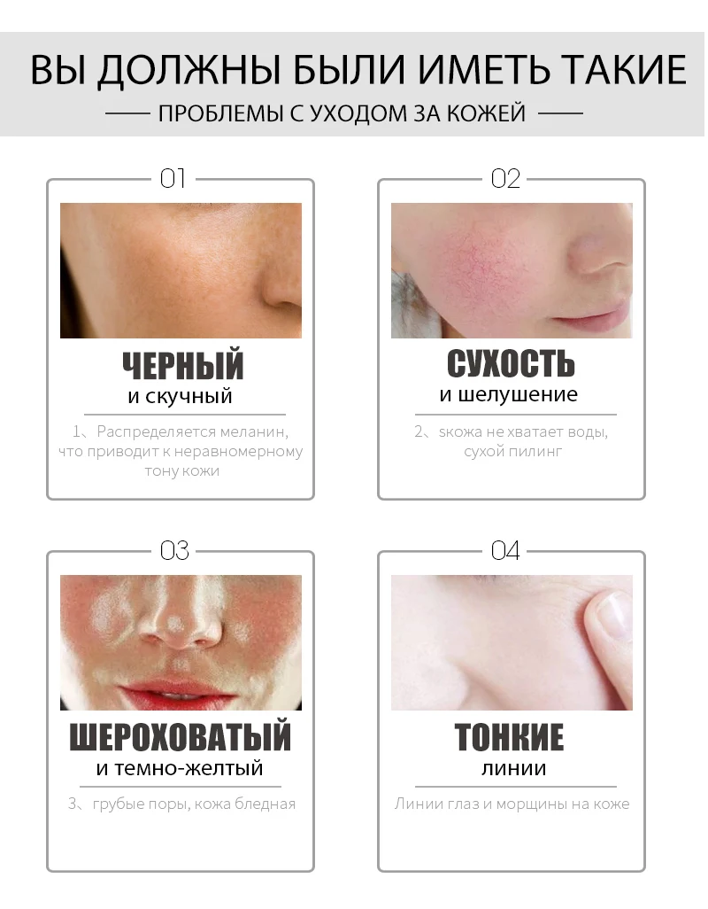 ROSALIND, против морщин, против старения, для лица, улиточный крем, гиалуроновая кислота, питательный уход за кожей, для акне, для кожи, светлее, отбеливающий крем