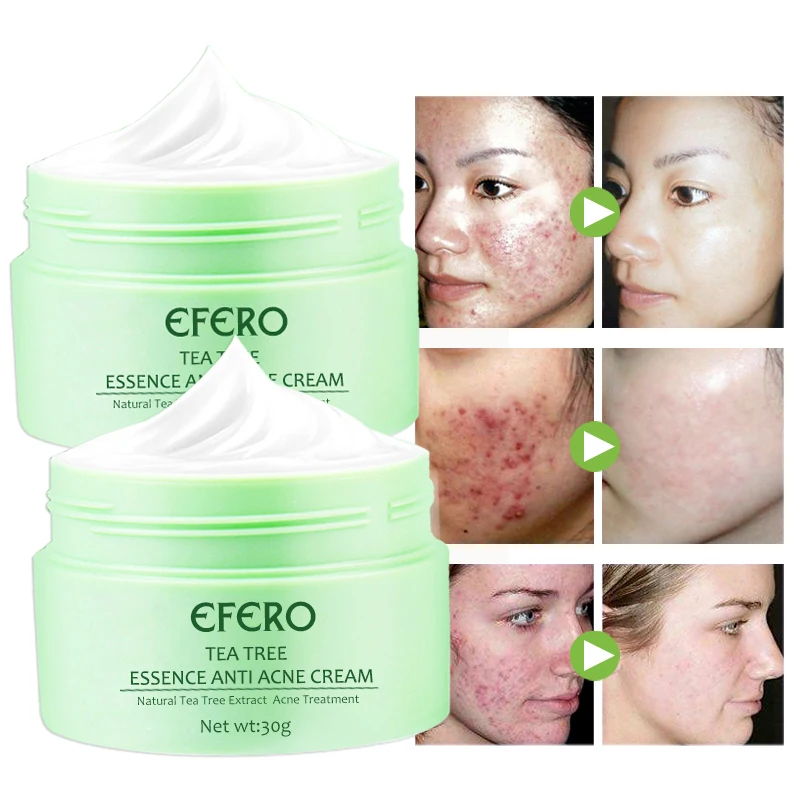 

4pcs Snail Face Cream Anti Wrinkle Cream for Face Skin Care Repair Acne Treatment Hyaluronic Aicd Shrink Pores Moist Face Cream
