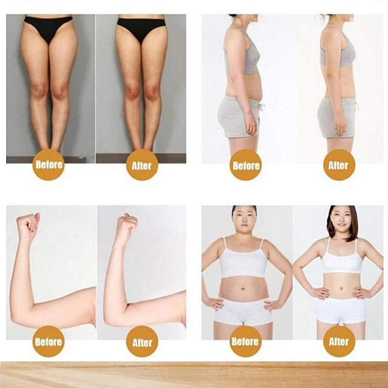 20 шт./10 пакетов пластырь для сжигания жира | Красота и здоровье