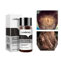 lanbena natural fast powerful hair growth essence anti hair loss essential oil