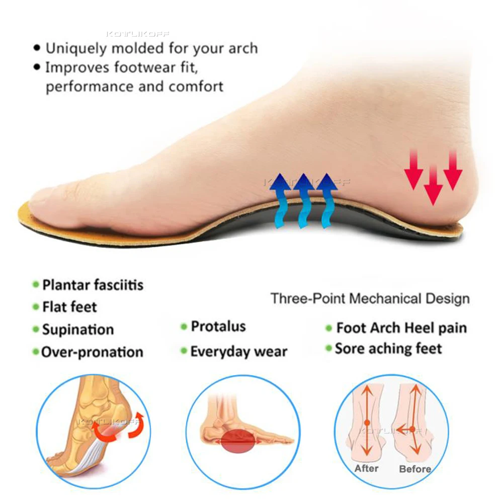 KOTLIKOFF Leather Orthotic Insoles For Feet Orthopedic Shoes Sole Flat Arch Support Deodorant Insole O/X Leg Corrected | Обувь