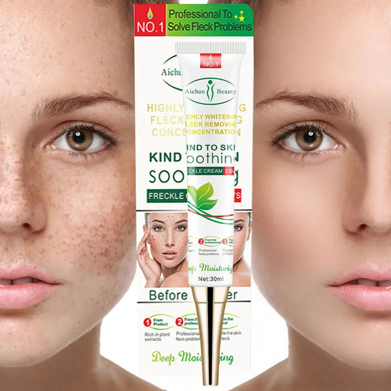 

Effective whitening freckle cream to remove chloasma acne spots pigment melanin dark spots whitening moisturizing skin care 30g