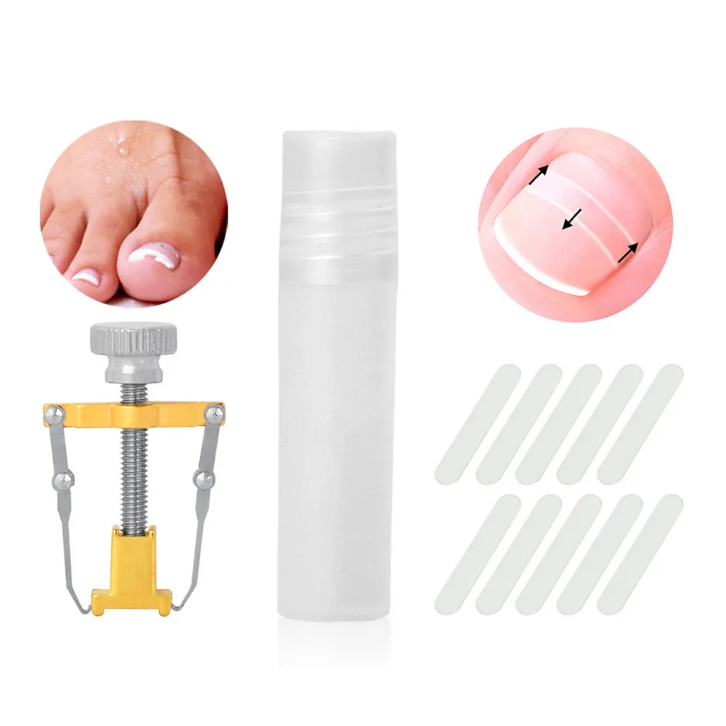 

Ingrown Paronychia Toenail Corrector Correction Fixer Pedicure Stickers Set