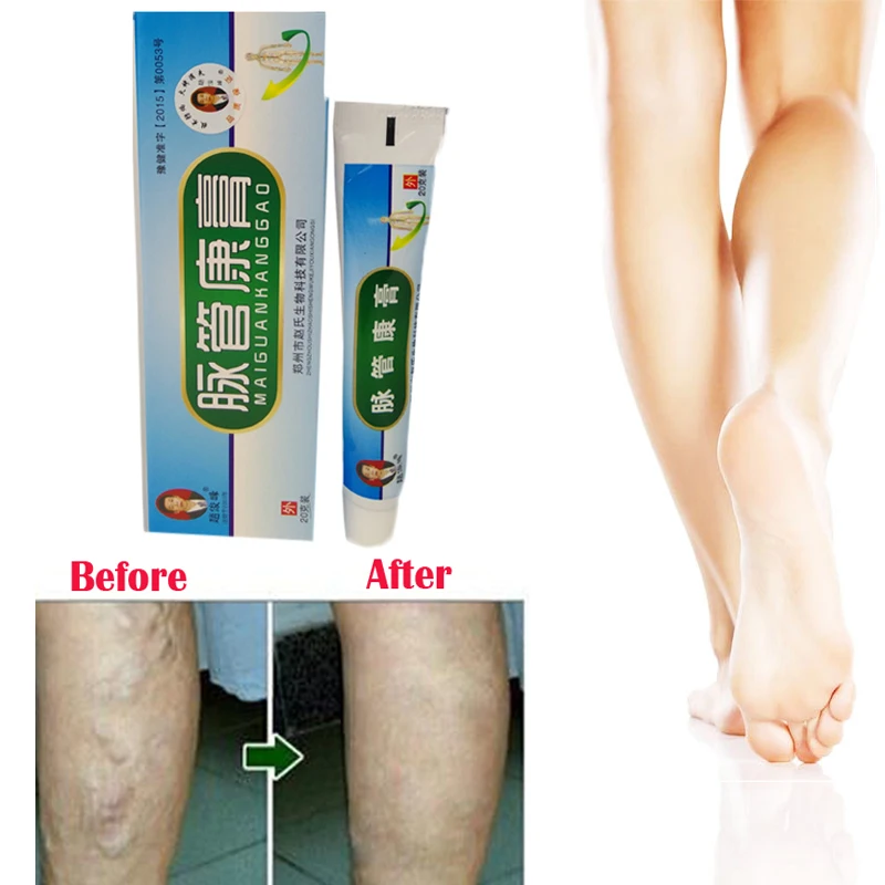 Мазь для варикозных вен лечение васкулитов ангиитов кровеносных сосудов гнилых