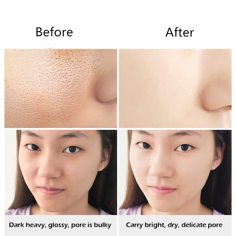 Очищающее средство для морской соли 100 г поры удаления прыщей лечение акне