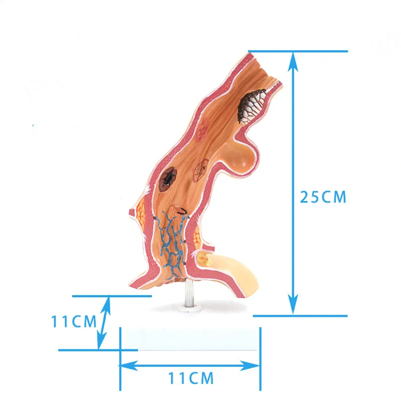 

Esophagus Anatomical model Alimentary system Pathological anatomical model of esophagus medical teaching aids