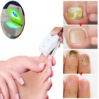 effective nail fungus light therapy treatment device cure nail fungal infection onychomycosis removal machine